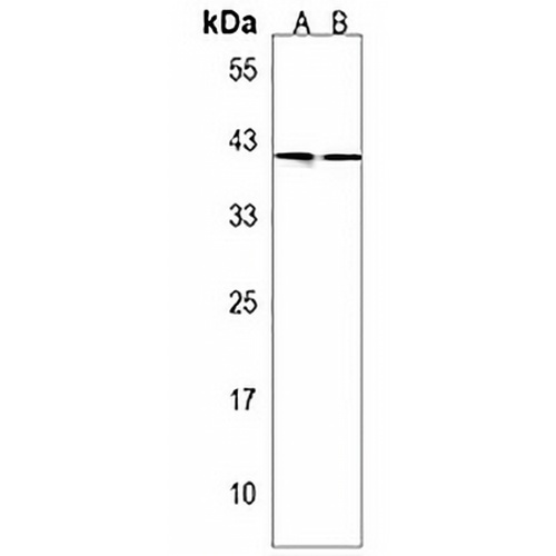 Gamma-Actin Rabbit Polyclonal Antibody
