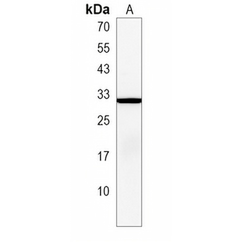 ARF3 Rabbit Polyclonal Antibody