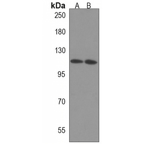 CTDP1 Rabbit Polyclonal Antibody