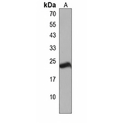 SPCS3 Rabbit Polyclonal Antibody