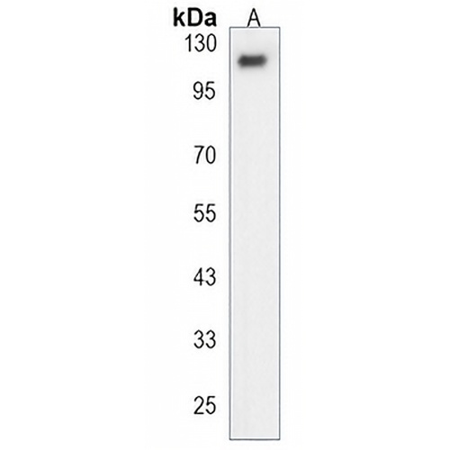 ESPN Rabbit Polyclonal Antibody