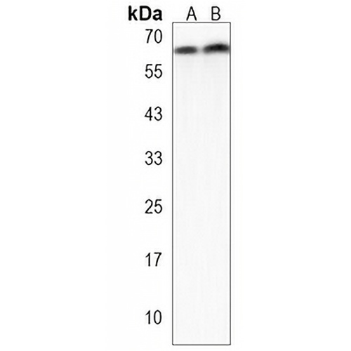 GALK2 Rabbit Polyclonal Antibody