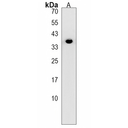 PANK1 Rabbit Polyclonal Antibody