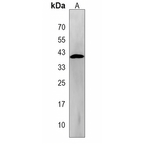 PANK3 Rabbit Polyclonal Antibody