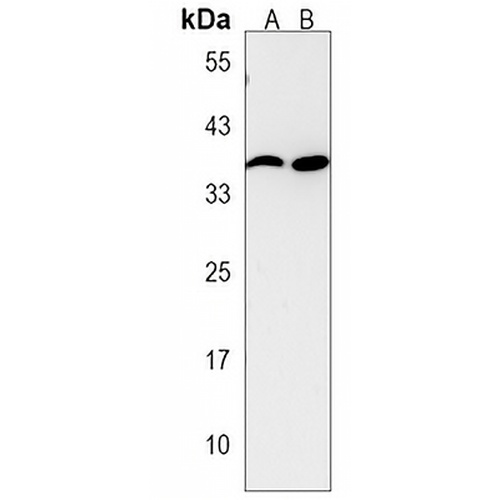 CaMK1 alpha Rabbit Polyclonal Antibody