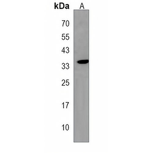 HMX2 Rabbit Polyclonal Antibody