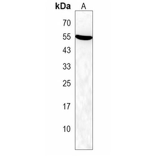 BTBD1 Rabbit Polyclonal Antibody