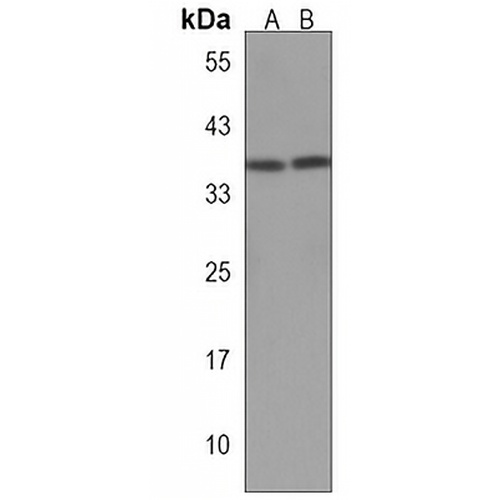 HMX3 Rabbit Polyclonal Antibody