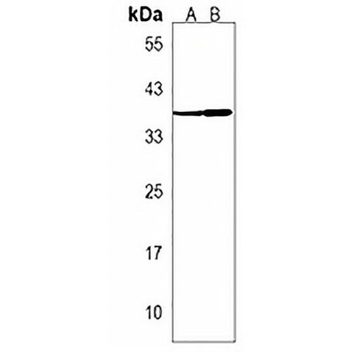 EN2 Rabbit Polyclonal Antibody