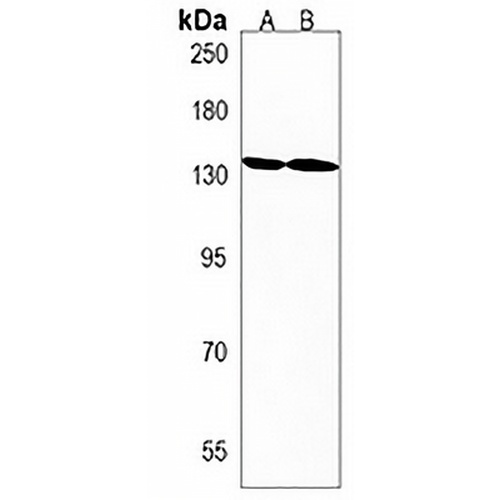 HIPK3 Rabbit Polyclonal Antibody