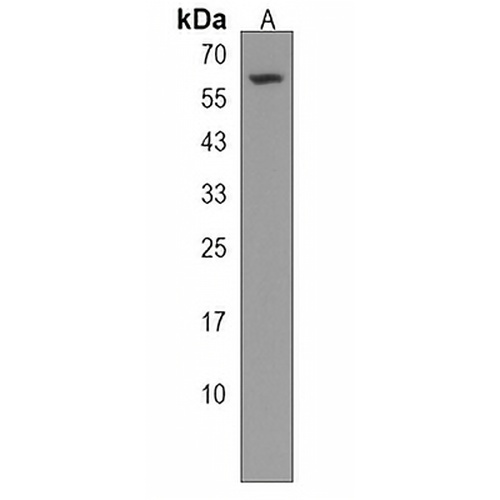 CDK17 Rabbit Polyclonal Antibody