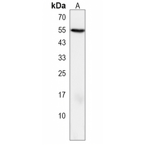 CLIC5 Rabbit Polyclonal Antibody