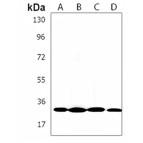 CABP1 Rabbit Polyclonal Antibody