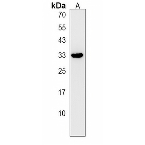 MPST Rabbit Polyclonal Antibody