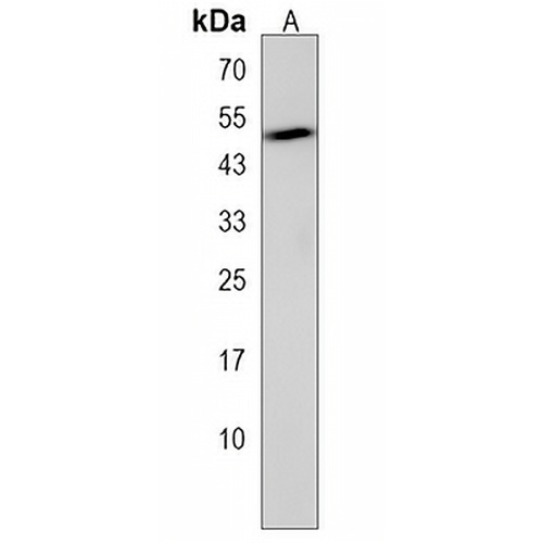 SRMS Rabbit Polyclonal Antibody