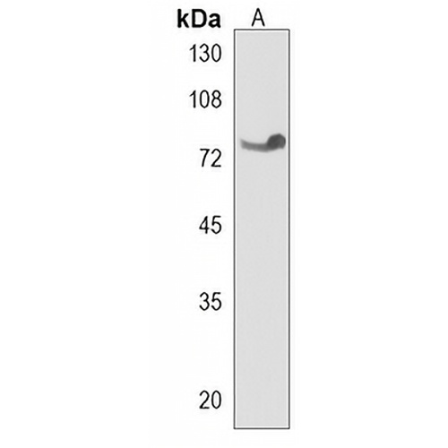 TNK1 Rabbit Polyclonal Antibody