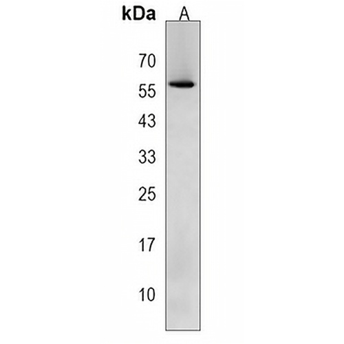 Cytochrome P450 4A11 Rabbit Polyclonal Antibody