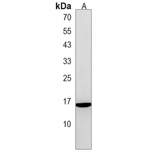 ALOX5AP Rabbit Polyclonal Antibody