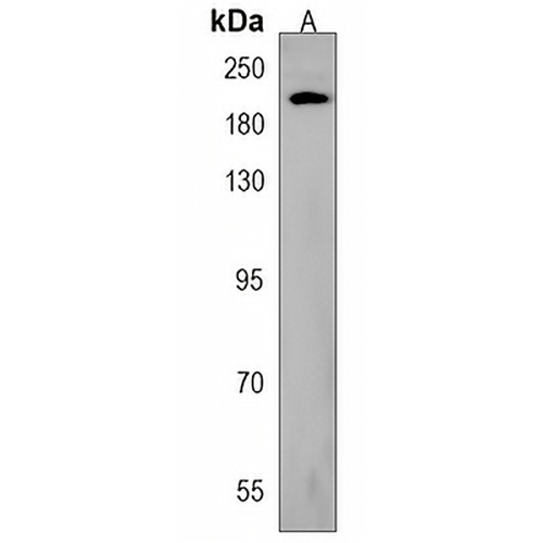 TRPM7 Rabbit Polyclonal Antibody