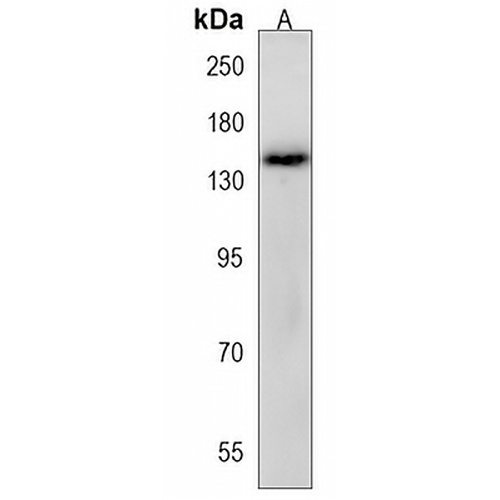 NEK1 Rabbit Polyclonal Antibody