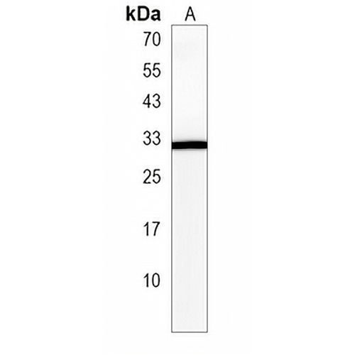 NME5 Rabbit Polyclonal Antibody