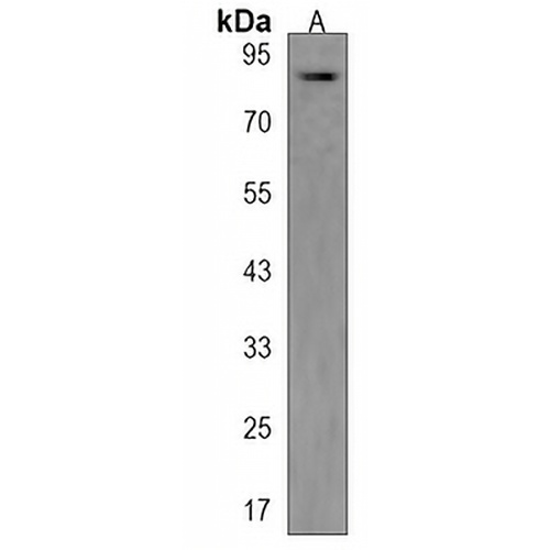 ARHGAP26 Rabbit Polyclonal Antibody