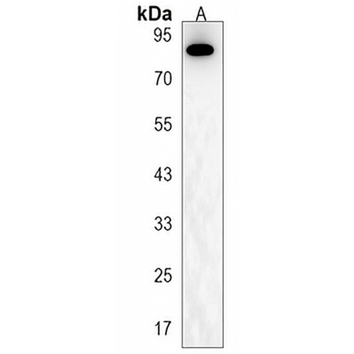 CCHCR1 Rabbit Polyclonal Antibody