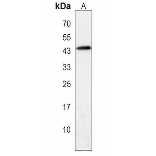 CECR5 Rabbit Polyclonal Antibody