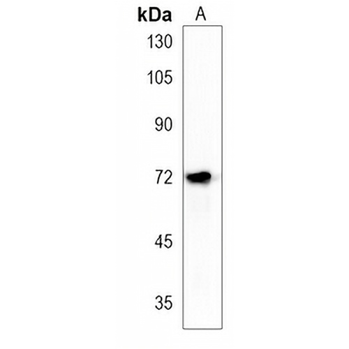 ACSS3 Rabbit Polyclonal Antibody