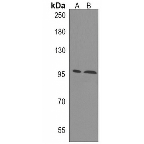 ANO5 Rabbit Polyclonal Antibody