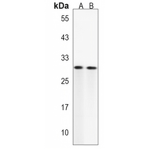 DIO2 Rabbit Polyclonal Antibody