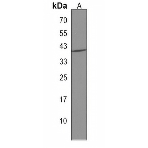 ARPC1B Rabbit Polyclonal Antibody
