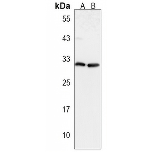 CTHRC1 Rabbit Polyclonal Antibody