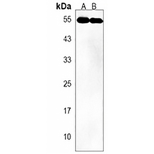 UBAP1 Rabbit Polyclonal Antibody