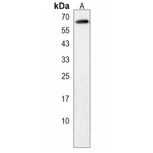DOLK Rabbit Polyclonal Antibody