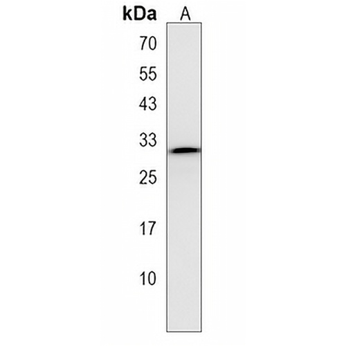 ZFP36 Rabbit Polyclonal Antibody