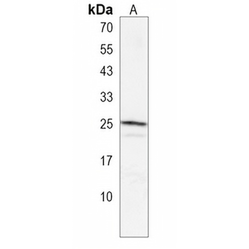 GSTA4 Rabbit Polyclonal Antibody