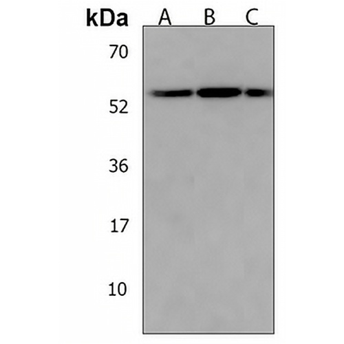 PPP1R36 Rabbit Polyclonal Antibody