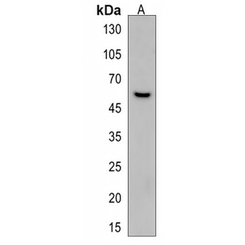 DAB2 Rabbit Polyclonal Antibody