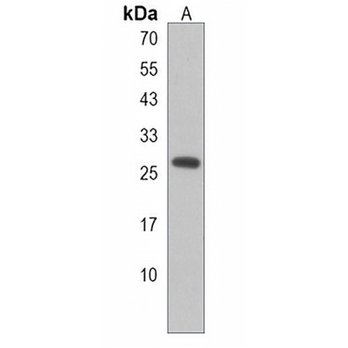 PEX11A Rabbit Polyclonal Antibody