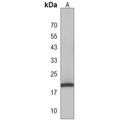 DLK2 Rabbit Polyclonal Antibody