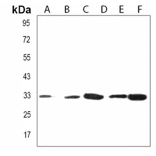 OR2H2 Rabbit Polyclonal Antibody