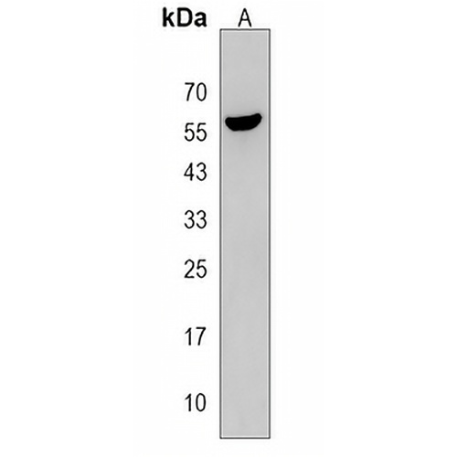 CDC14B Rabbit Polyclonal Antibody