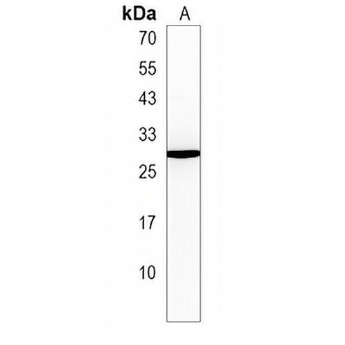 CCDC85B Rabbit Polyclonal Antibody