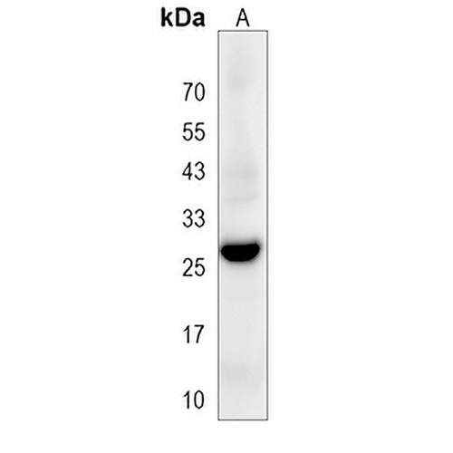 CLRN3 Rabbit Polyclonal Antibody