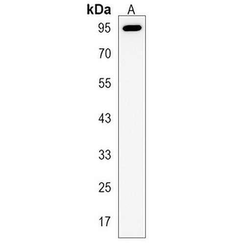 BAHD1 Rabbit Polyclonal Antibody