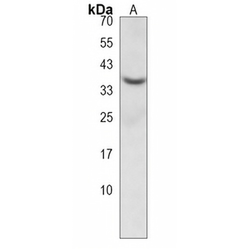 CRELD2 Rabbit Polyclonal Antibody