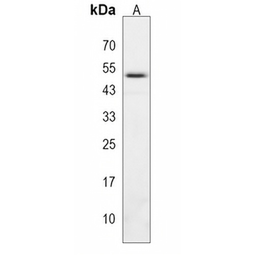 ADH6 Rabbit Polyclonal Antibody