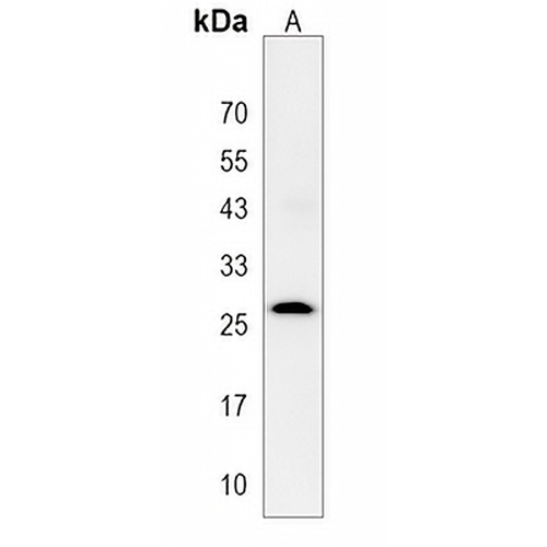 TSPAN6 Rabbit Polyclonal Antibody