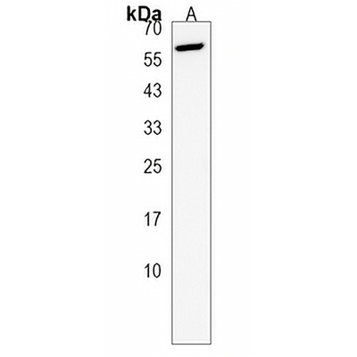 ACTR5 Rabbit Polyclonal Antibody